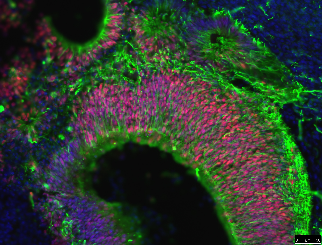 Fluorescently labelled cells in a brain organoid.