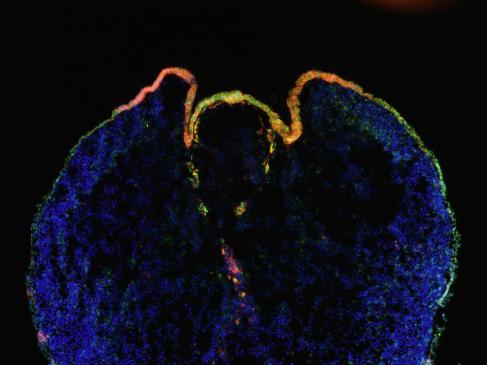 Neural stem cells in yellow/red in the ventricles at week 2 of development Onorati M., Castiglioni V., Biasci D., Cesana E., Menon R., Vuono R., Talpo F., Goya R.L., Lyons P.A., Bulfamante G.P., Muzio L., Martino G., Toselli M., Farina C., Barker R.A., Biella G., Cattaneo E.