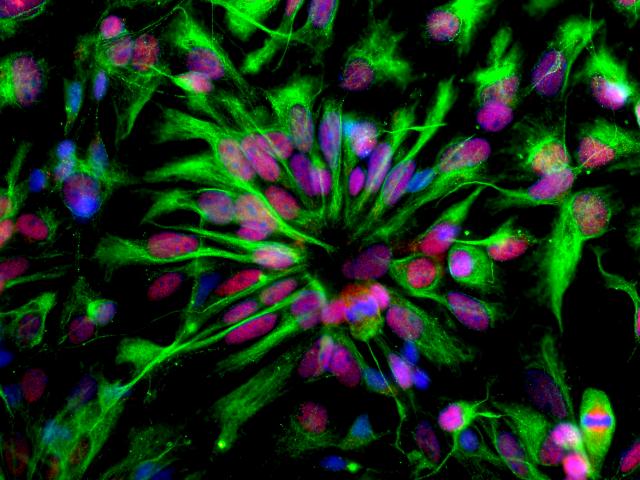 Human neuroepithelial stem cells self-organize into rosette-like patterns, resembling the developing neural tube. They were used to understand how Zika virus infection works and to block its proliferation.