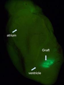 Mouse heart with a graft of cardiomyocytes grown from human embryonic stem cells