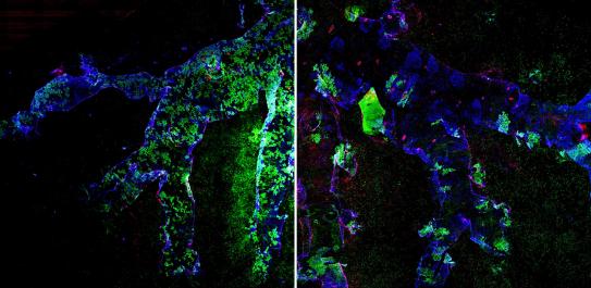 Fluorescence tagging of progenitor and stem cells before and after lung injury