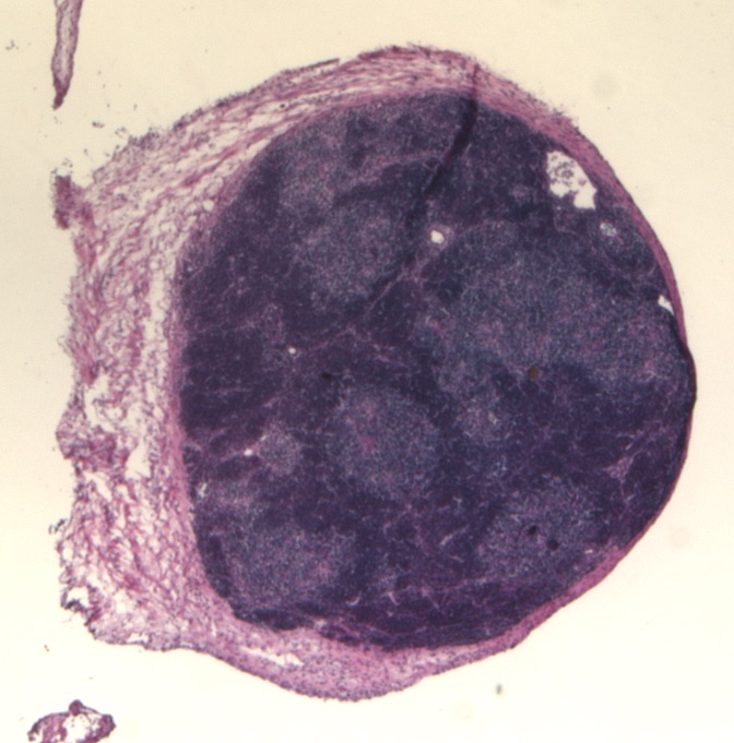 The image shows a thymus organoid, which is a small ball of cells capable of forming a thymus when transplanted. Thymus cells are stained purple. 