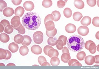 What is a healthy range for white blood cells?