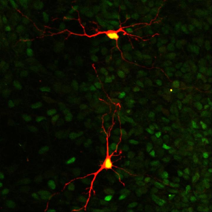 Mittlere stachelige Neurone