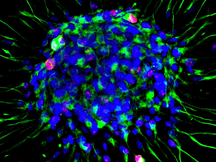 Mouse neural stem cells
