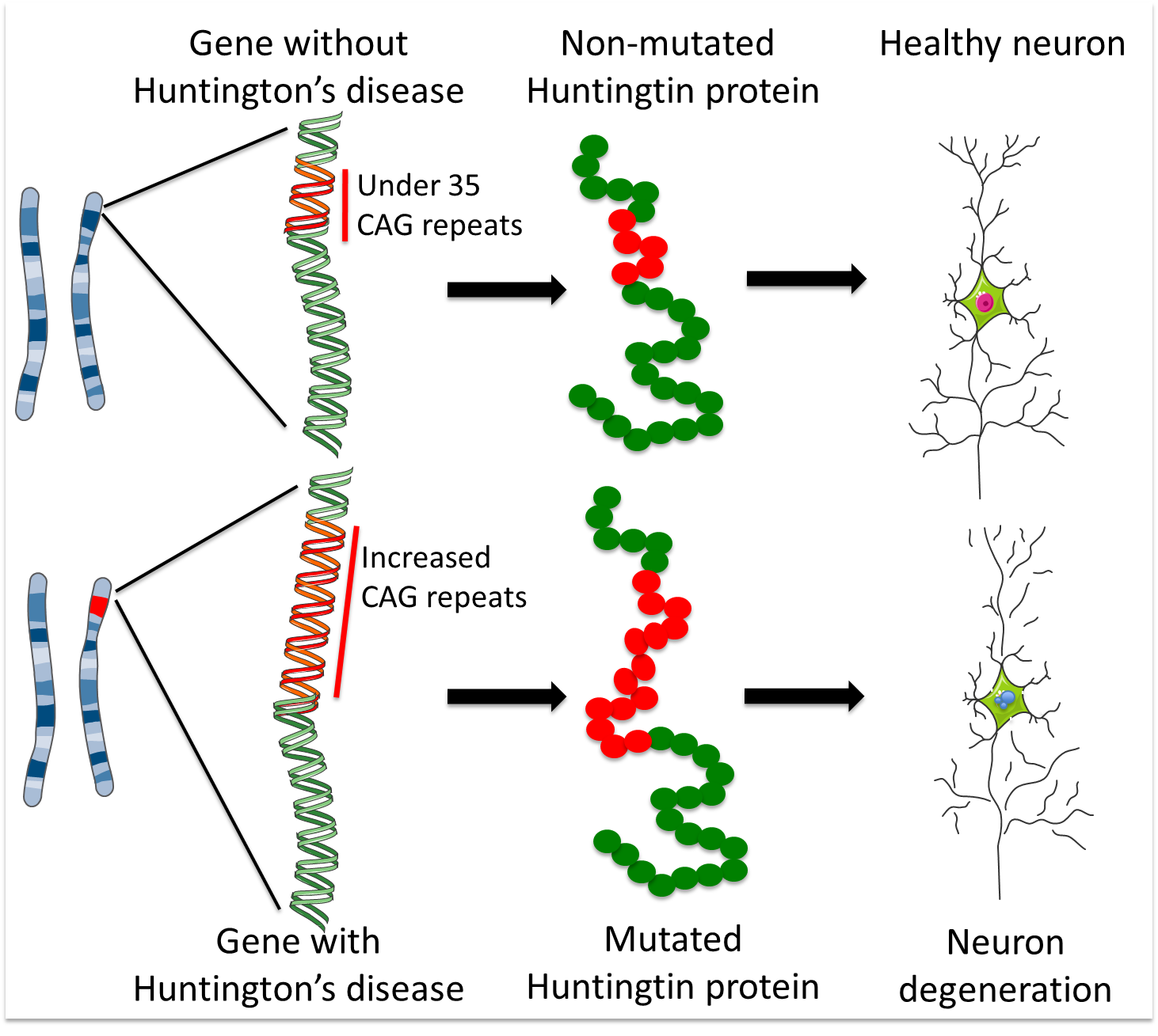 Huntington's disease diagram