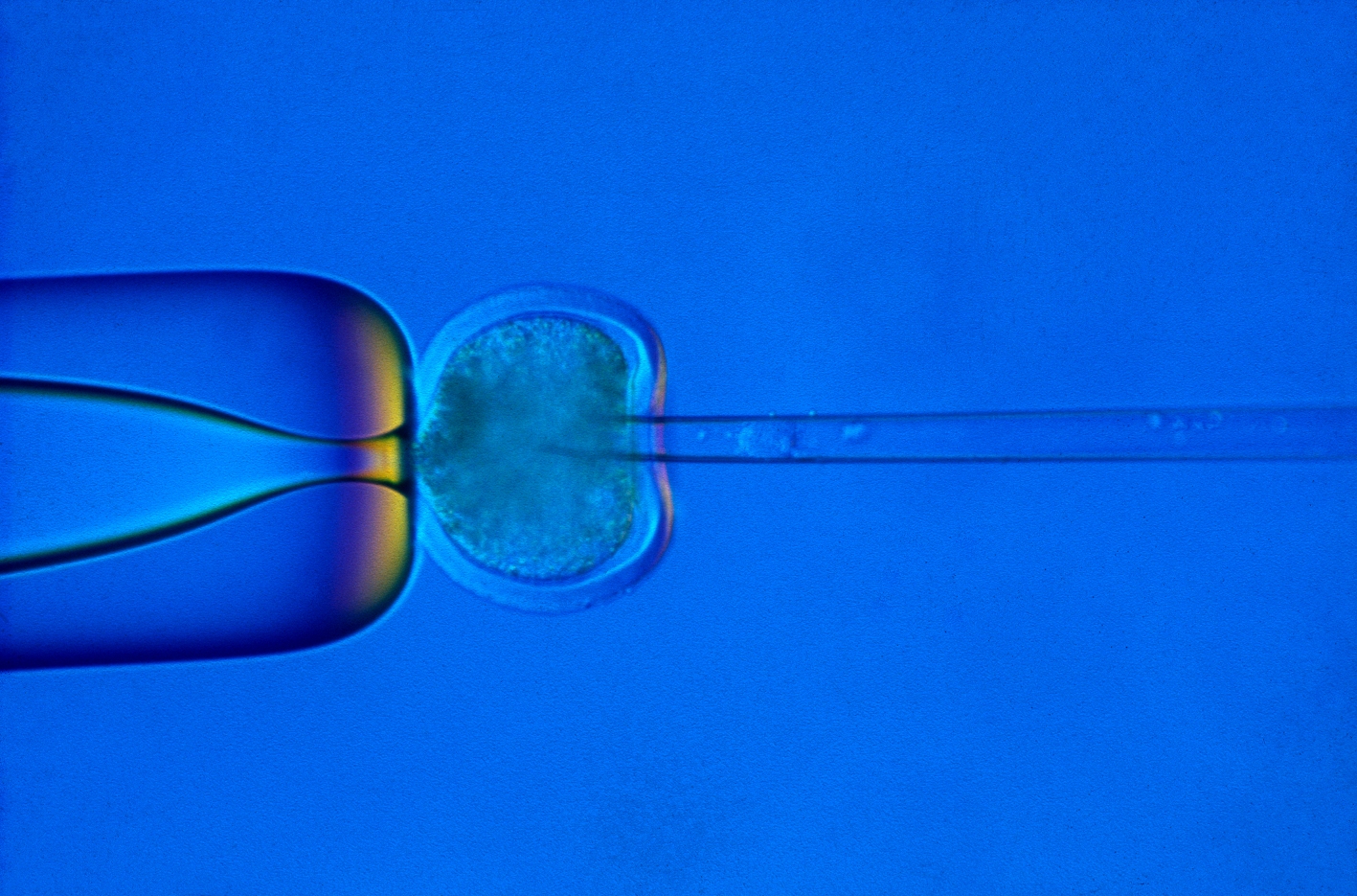 Nucleus being injected into an egg cell in somatic cell nuclear transfer