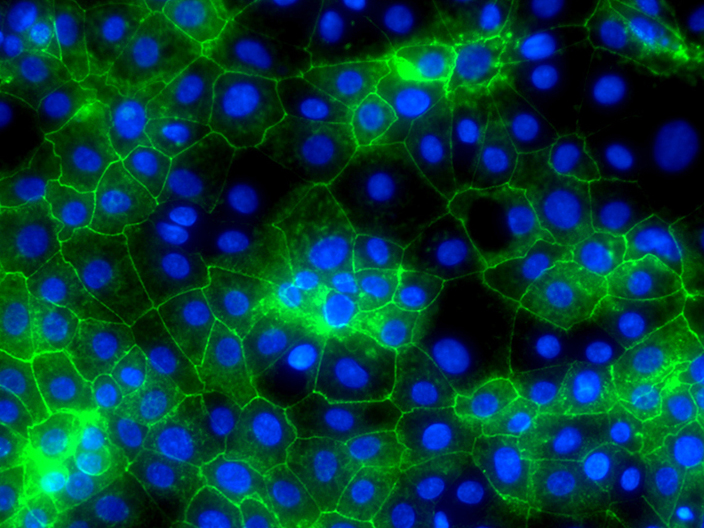 Hepatocyte-like cells grown from human embryonic stem cells