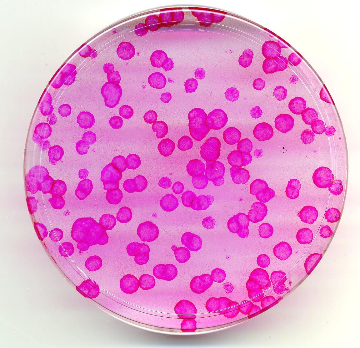 Keratinocyte colonies