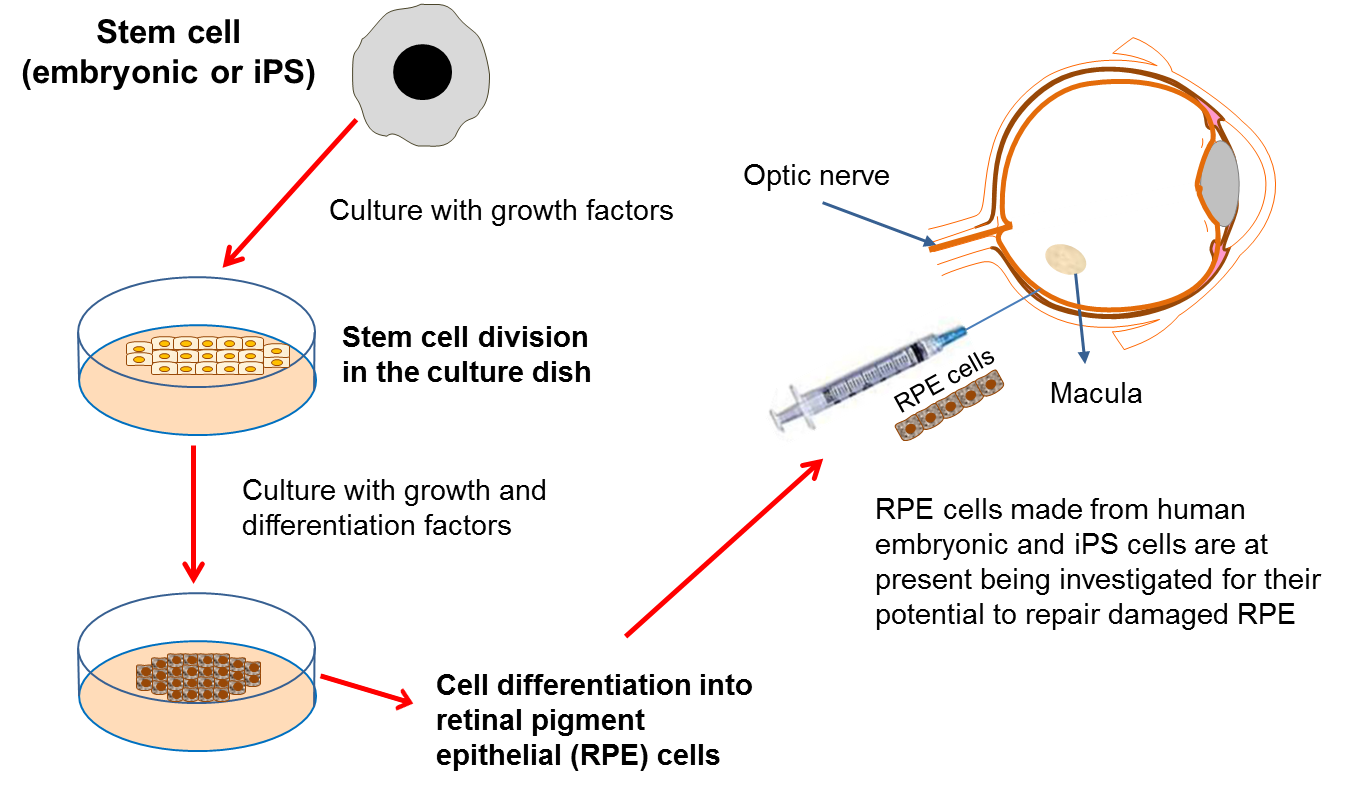 stem cell technology to cure eye diseases research paper