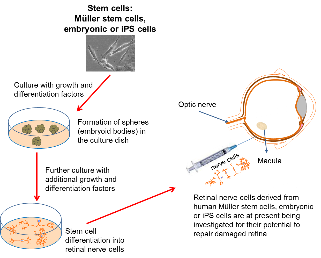 Diagram on making retinal nerve cells