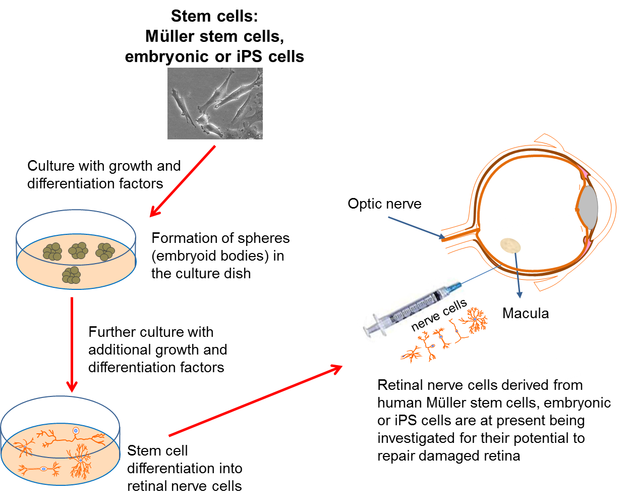 stem cell technology to cure eye diseases research paper