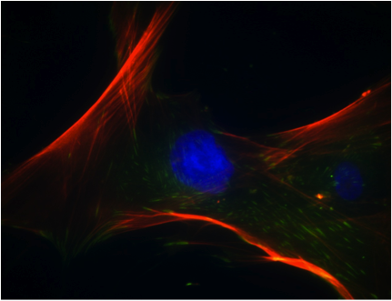 Human mesenchymal stem cells