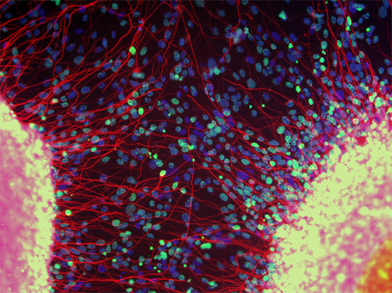 Human neural stem cells