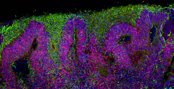 Corticol organoid