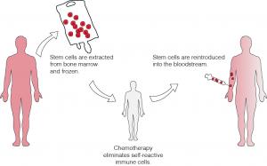 AHSCT Scheme