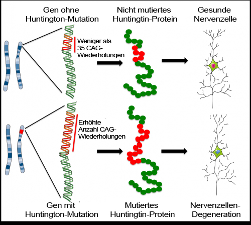 Huntington-Krankheit