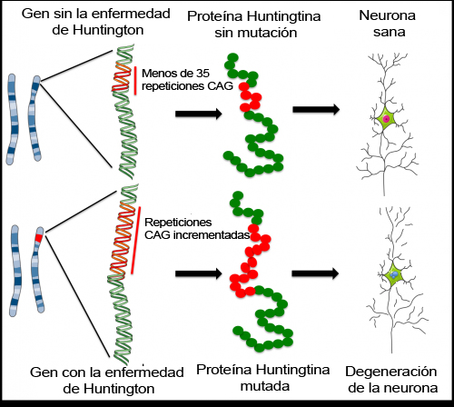 Enfermedad de Huntington