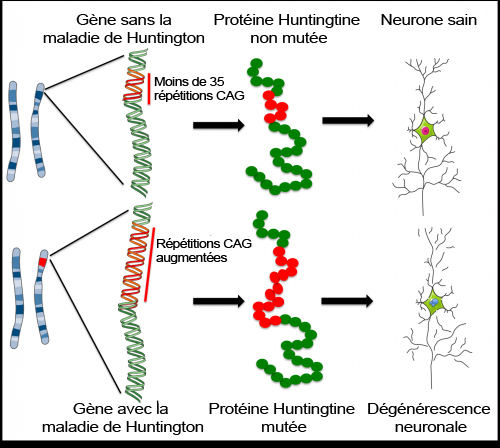 La maladie de Huntington 