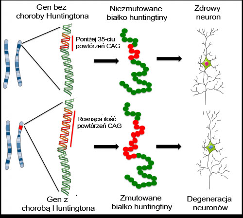 Choroba Huntingtona