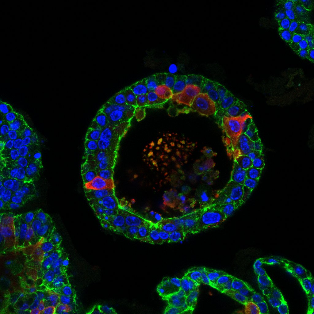 Tear gland organoid