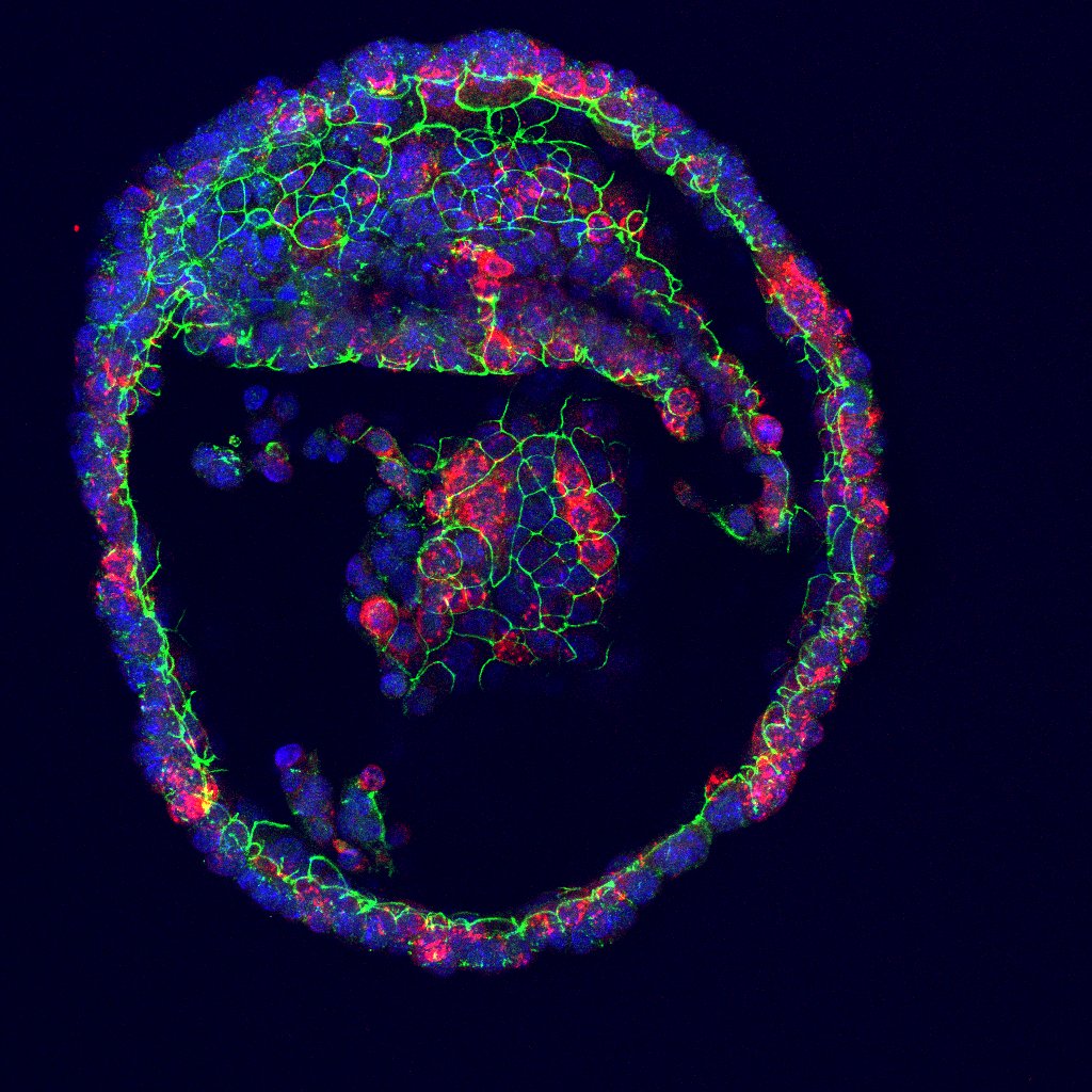 Tear gland organoid