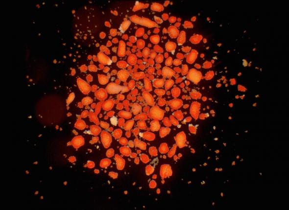 Isolated islets of Langerhans used for transplantation 