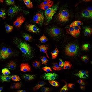 Anti-inflammatory macrophages from the rat brain grown in the laboratory. The green represents an anti-inflammatory protein and the red represents a protein made by macrophages only. Credit Veronique Miron, MRC Centre for Regenerative Medicine