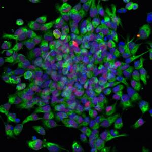 Neural stem cells (mouse)