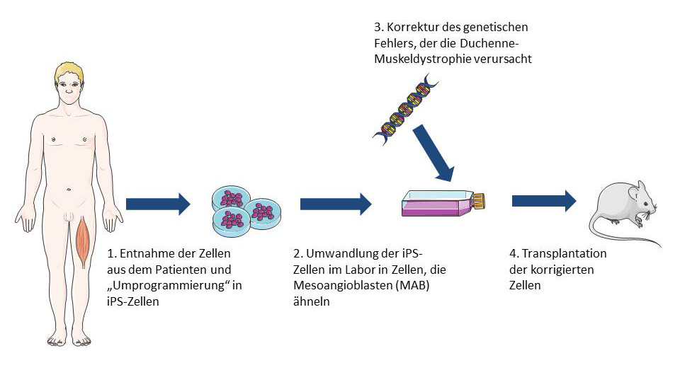 Möglicher Weg zur Zelltherapie gegen Muskeldystrophie