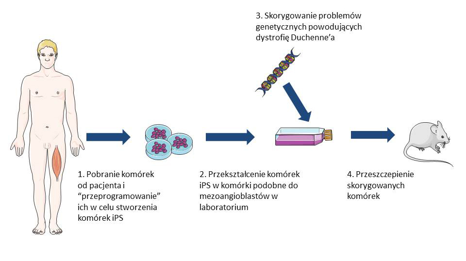 Możliwy kierunek rozwoju terapii dystrofii mięśniowej