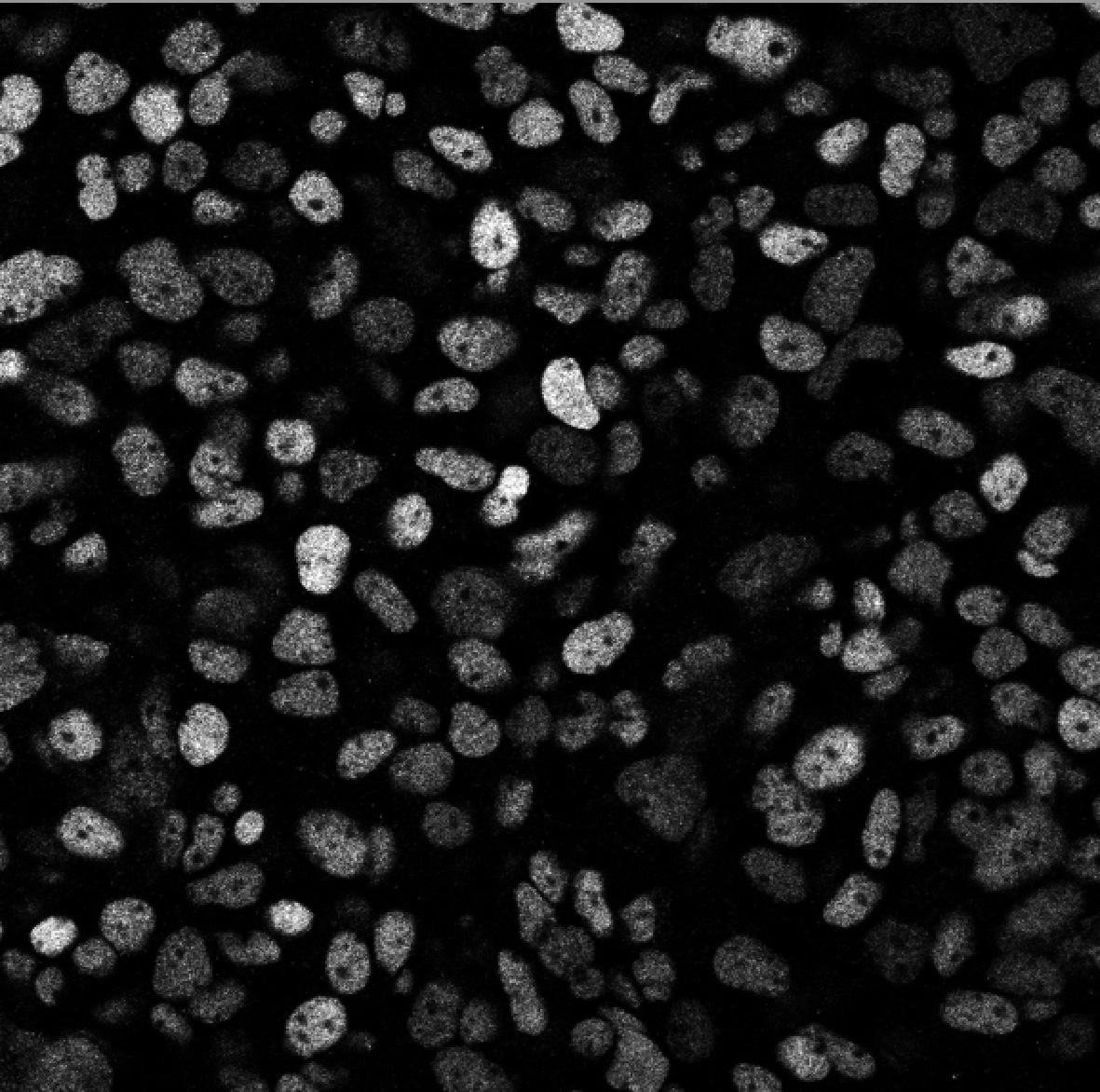 Pancreatic progenitors derived from human embryonic stem cells