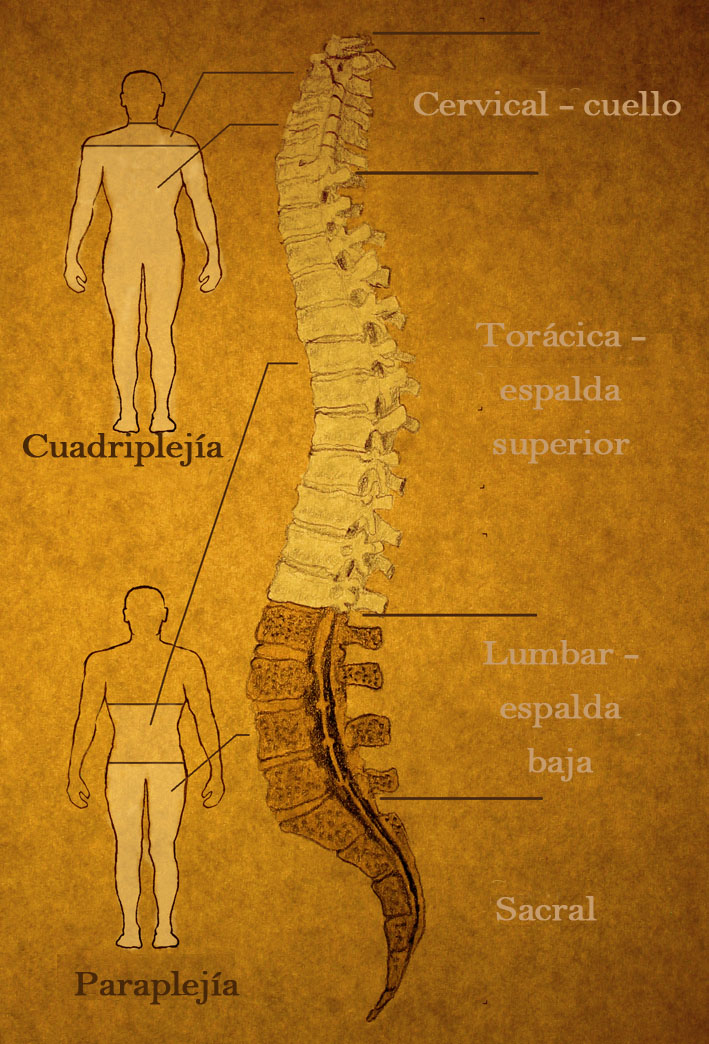 La médula espinal tiene diferentes secciones. El nivel de parálisis depende de la localización de la lesión.