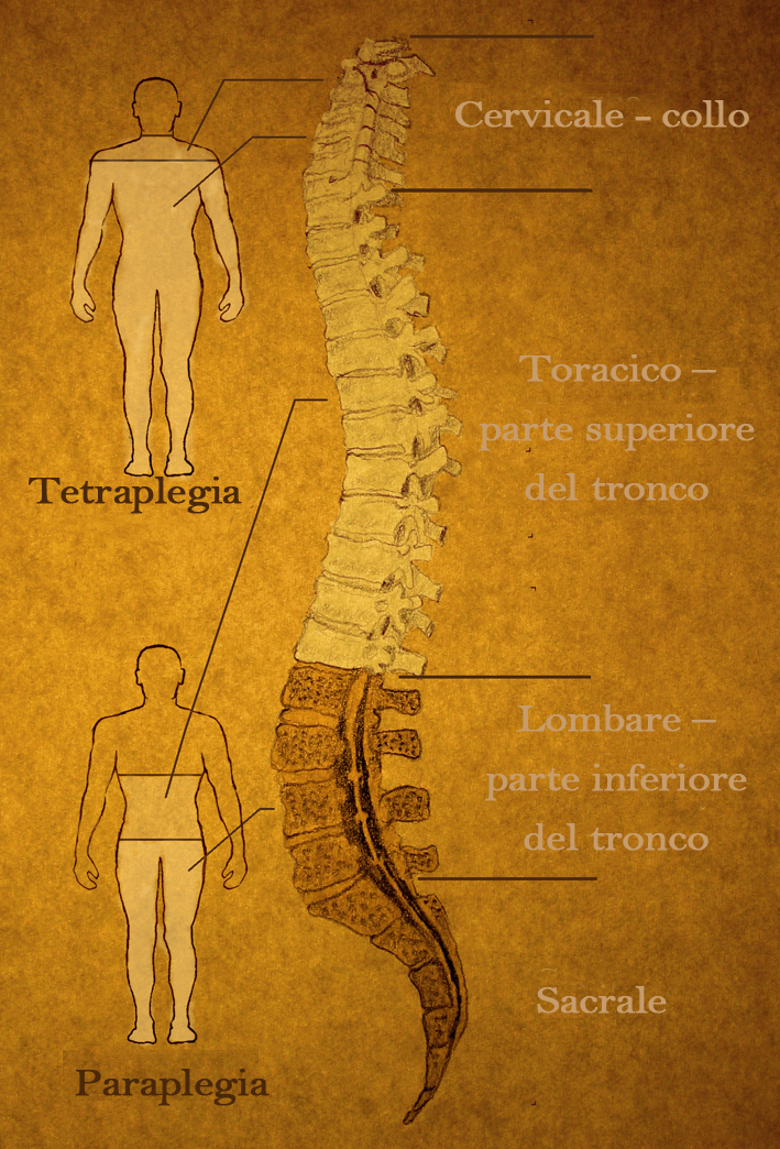 The spine has different sections. The level of paralysis depends on the location of the injury.