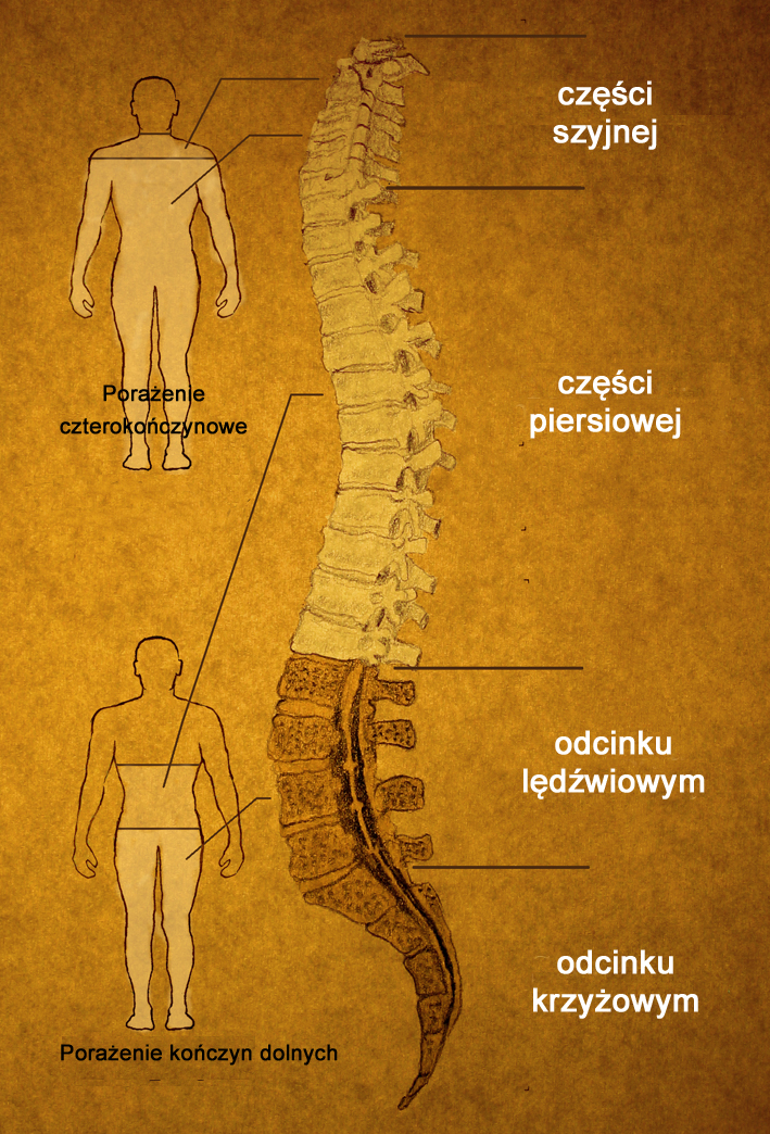 The spine has different sections. The level of paralysis depends on the location of the injury.