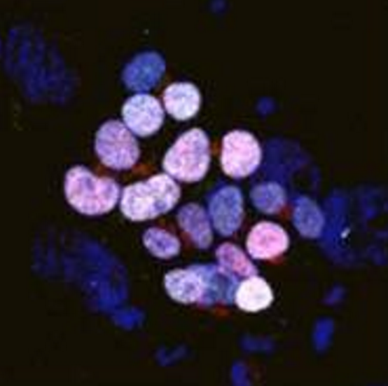 Similar to a human embryo, co-expression of KLF4, TFCP2L1 and NANOG can be seen in reset cells (Right).v Credit Prof A Smith and Dr Y Takashima