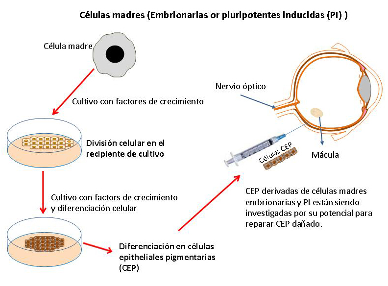 Desarollo de tratamientos para enfermedades del ojo