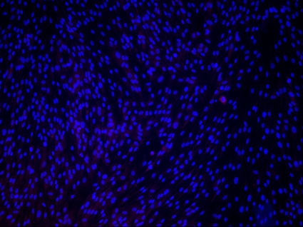 Human Fibroblasts stained with the neuronal marker MAP2 (red) and the nuclear marker DAPI (blue) before reprogramming. The absence of red marked cells signifies that despite many cells visible there are no neurons. Image: Andrew Yoo