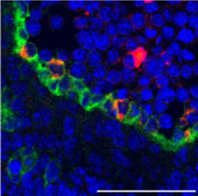 blood stem cells