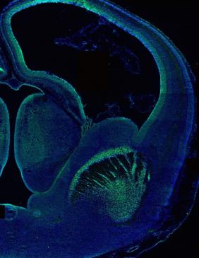 week 11 of development: neural stem cells shown in yellow/green in the ventricles