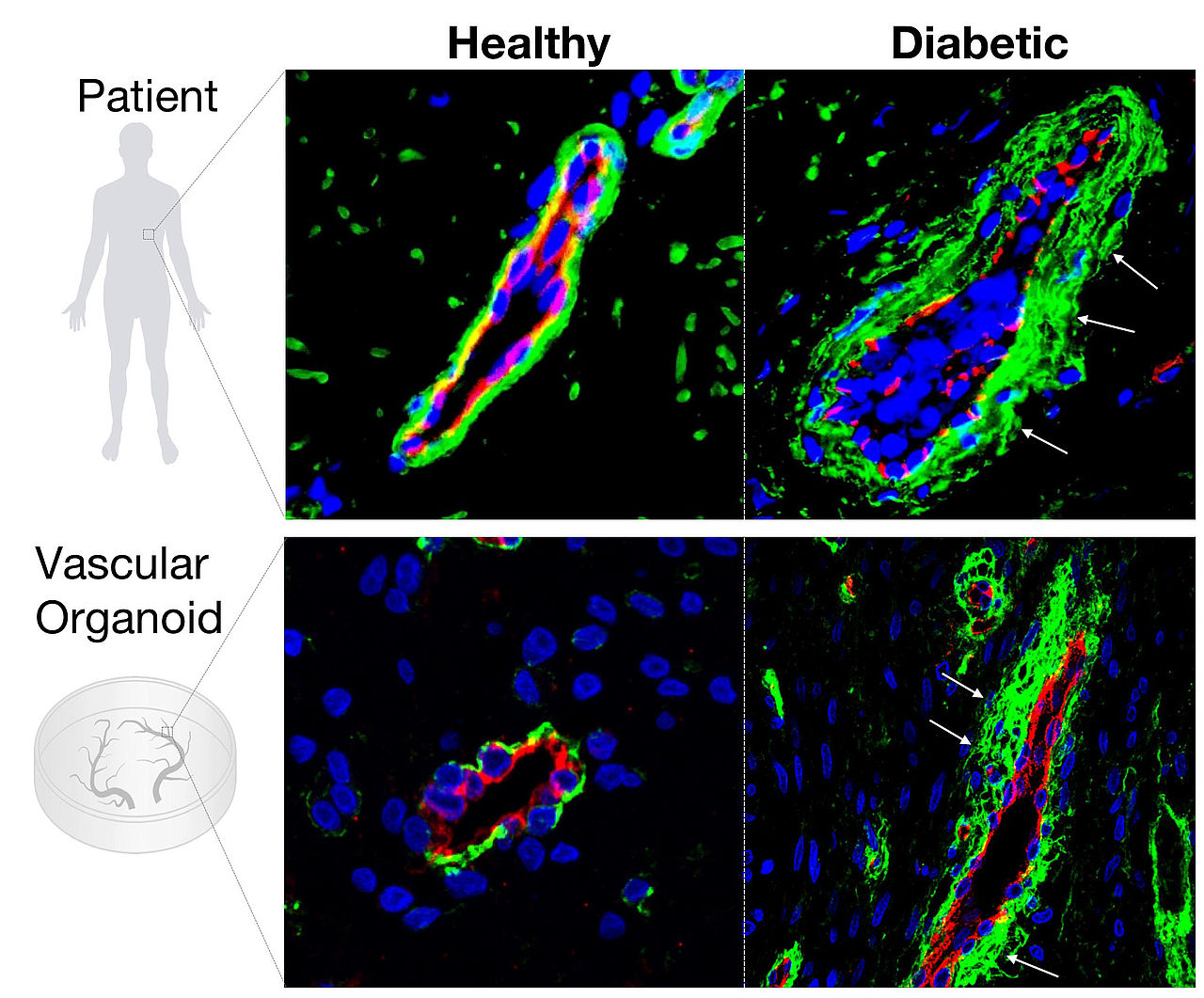 vascular organoids expanded