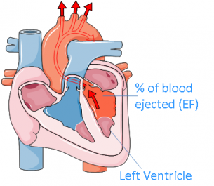 Improvement in heart function is commonly measured by the increase of ejection fraction (EF)