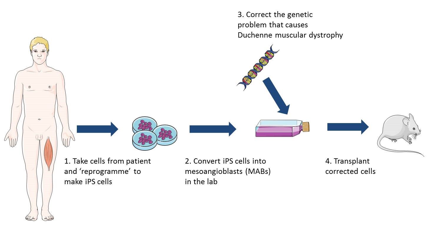 duchenne muscular dystrophy treatment