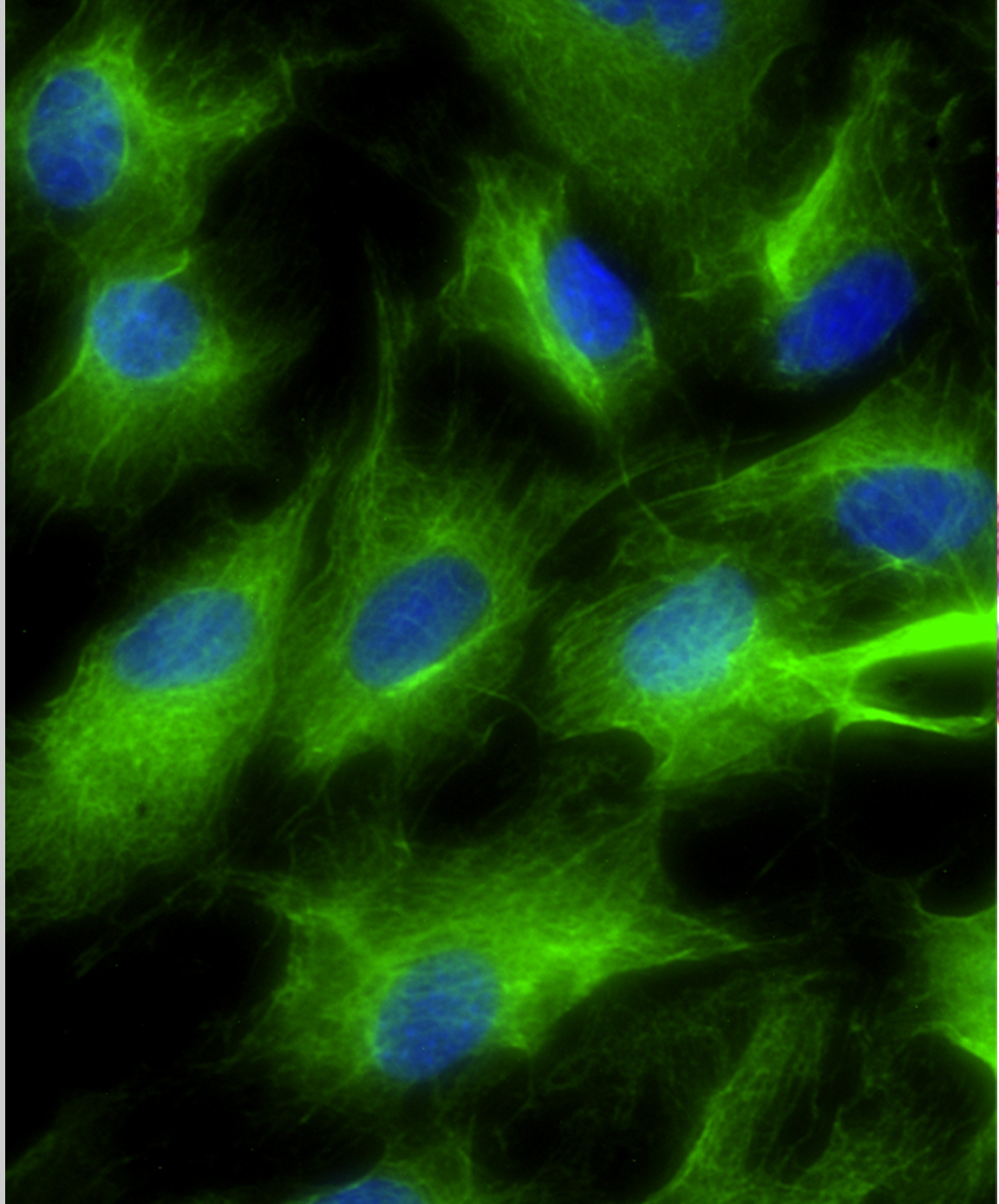 Fibroblasts transformed into induced thymic epithelial cells (iTEC) in vitro; iTEC are shown in green.Credit Nick Bredenkamp