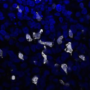 Insulin-producing cells made from human embryonic stem cells