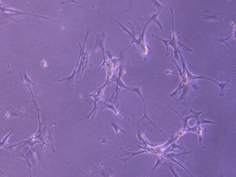 Possible kidney stem cells, growing in the lab
