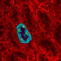 Microscope image of kidney tissue showing tubules.