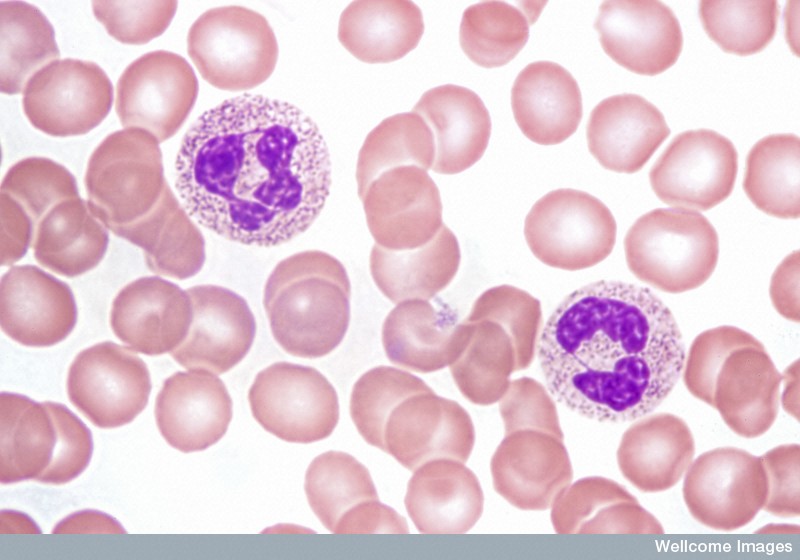 Healthy blood sample showing two white blood cells (neutrophils) and many red cells
