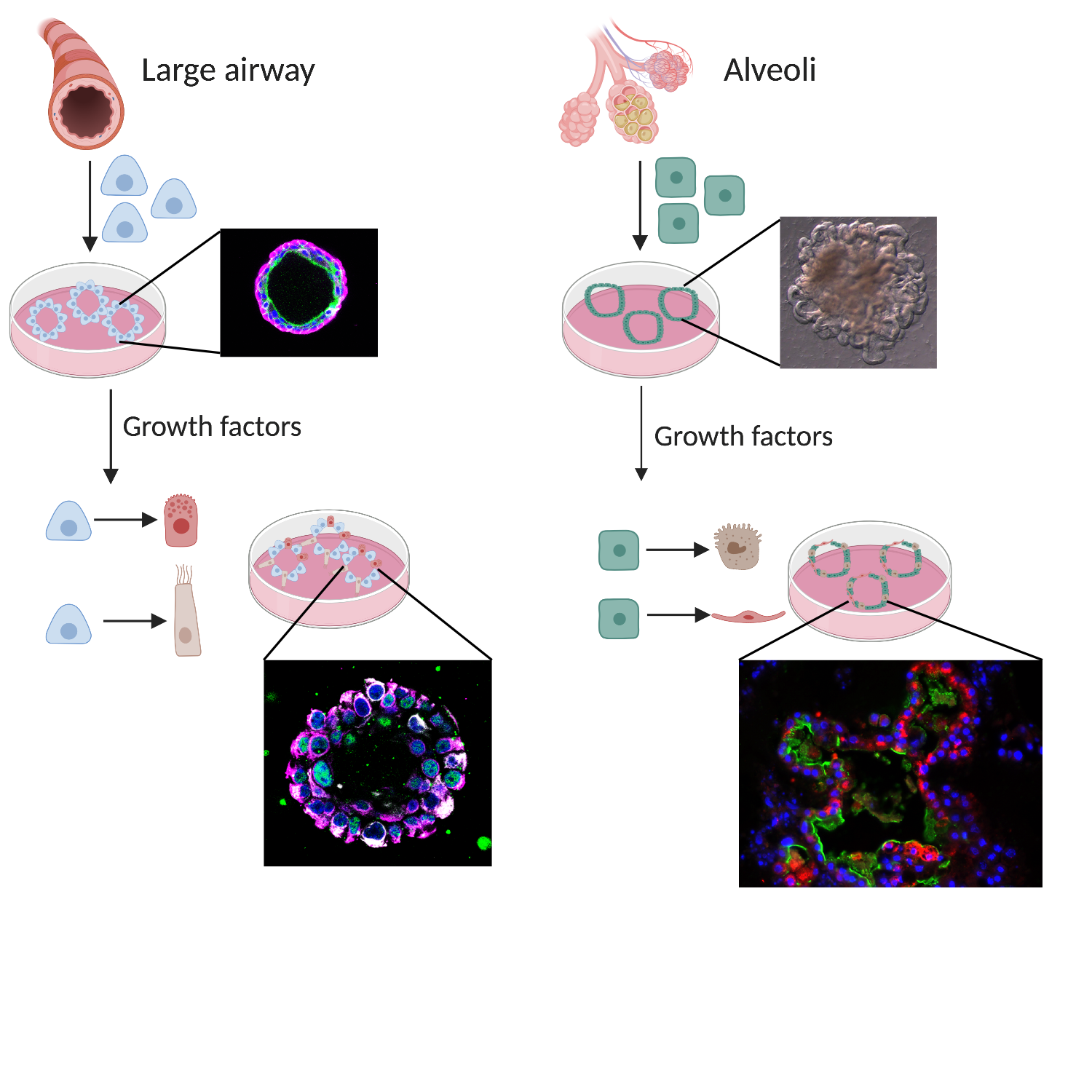 Diagram of lung organoid