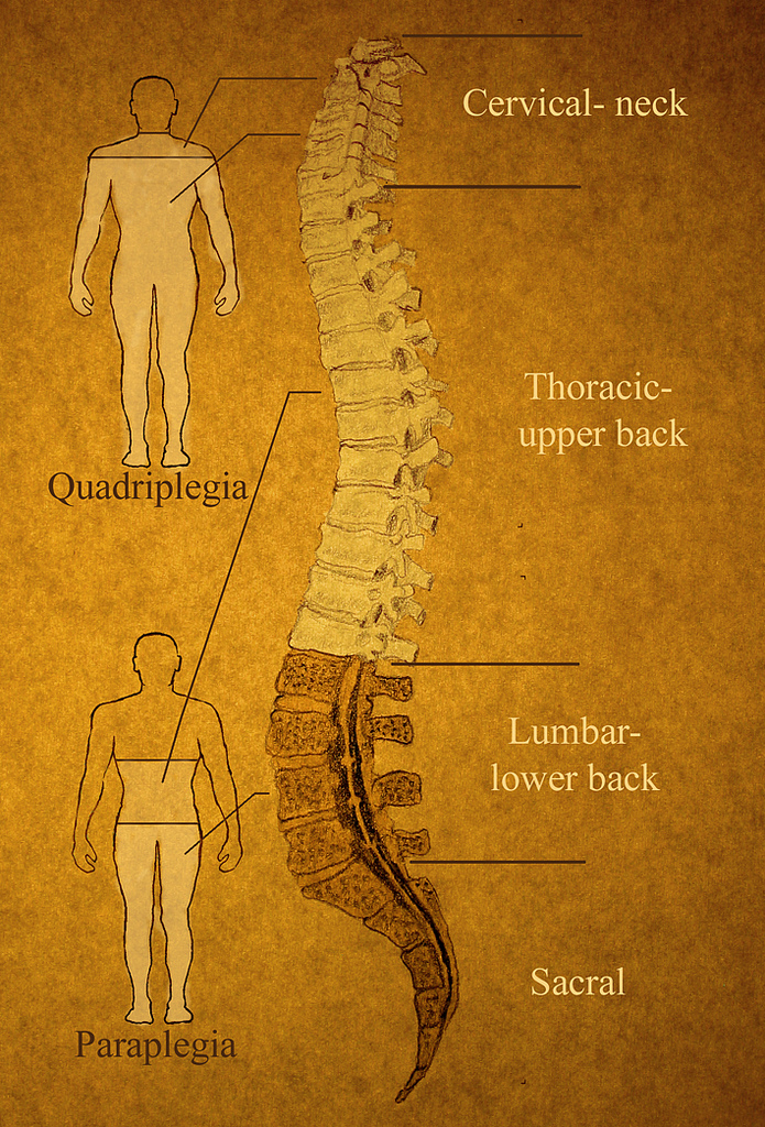 The spine has different sections. The level of paralysis depends on the location of the injury.